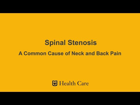Spinal Stenosis is a common cause of low back pain and sciatica - Capitol  Pain Institute