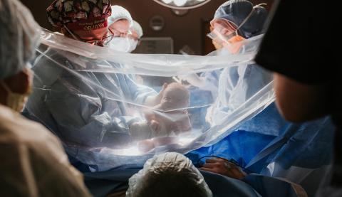 A Gentler C-Section